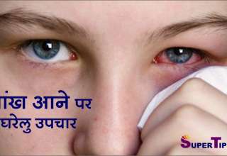 आँख आने पर घरेलू उपाय / aankh aana gharelu upchar - conjunctivitis