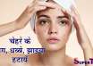 दाग धब्बे झाइयों के नुस्खे / pigmentation removal - daag dhabbe mitane ke nuskhe